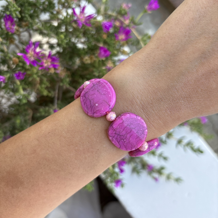 Pembe Tutku ayarlanabilir akrilik bileklik