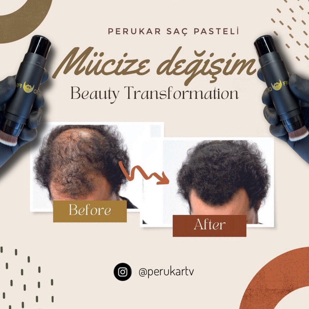 SEYREKLİK KAPATICI PASTEL