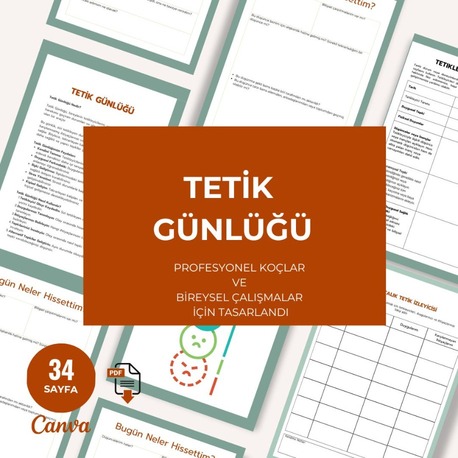 Tetik Günlüğü