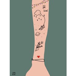 Arm