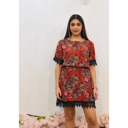 Dantelli Tunik (Elbise)