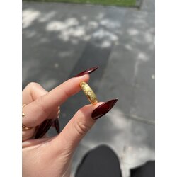 Işıltı yüzük