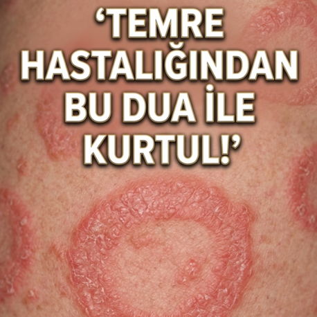 Temre Hastalığı İçin Manevi Şifa Rehberi (Dijital İndirme)