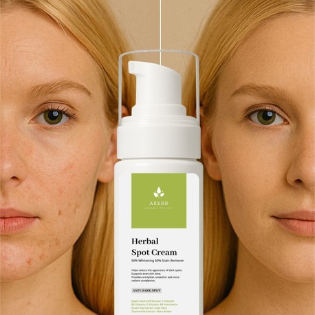 AKERD COSMETİCS LEKE KREMİ Beyazlatıcı Kararma