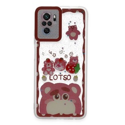 Newface Xiaomi Redmi Note 10 Kılıf Sweet Desenli Silikon Kapak
