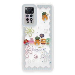 Newface Xiaomi Redmi Note 11 Pro Kılıf Sweet Desenli Silikon Kapak