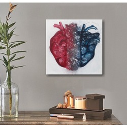 Heart attack