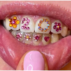 Tooth gem / Diş Pırlantası 