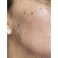 Yüz Peeling ve Bakım Jeli 50 g