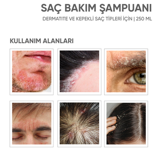Dermotitte Onaricı Saç Bakım Şampuanı | Dermatit ve Eğilimli Saç tipleri Için | 250 ml