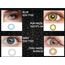 renkli lens