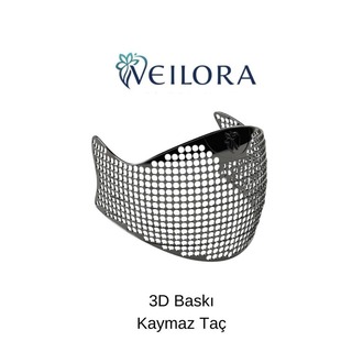 3D Baskı Kaymaz Taç - Veilora Flex Taç