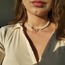 Beauty Choker 