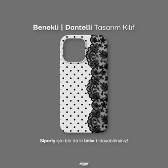 Benekli | Dantelli Tasarım Kılıf