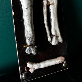 Bones Series - 3