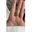 Anello