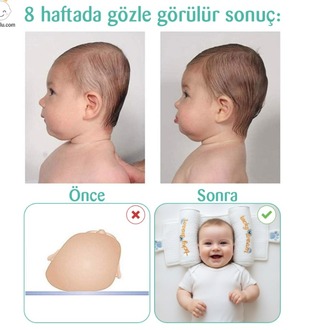 Ortopedik bebek düz kafa yastığı