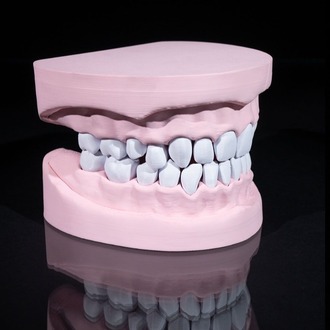 Diş Modeli