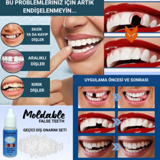 Moldable False Teeth Geçici Diş Onarım Seti,Takma Diş, Protez Diş, Geçici Diş, Diş Onarımı