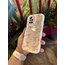Redmi Note 11/11s