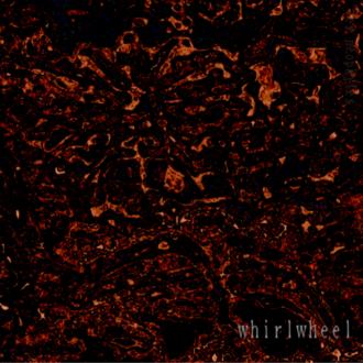 whirlwheel Poster