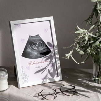 Kişiye Özel İlk Ultrason (Sonogram) Posteri | Hamilelik Duyuru ve Anı Tablosu ilk Tanışma