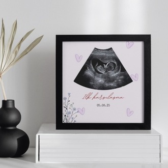 Kişiye Özel İlk Ultrason (Sonogram) Posteri | Hamilelik Duyuru ve Anı Tablosu ilk Tanışma