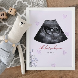 Kişiye Özel İlk Ultrason (Sonogram) Posteri | Hamilelik Duyuru ve Anı Tablosu ilk Tanışma