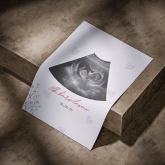 Kişiye Özel İlk Ultrason (Sonogram) Posteri | Hamilelik Duyuru ve Anı Tablosu ilk Tanışma