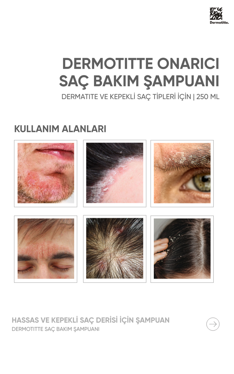 Dermotitte Onaricı Saç Bakım Şampuanı | Dermatit ve Eğilimli Saç tipleri Için | 250 ml