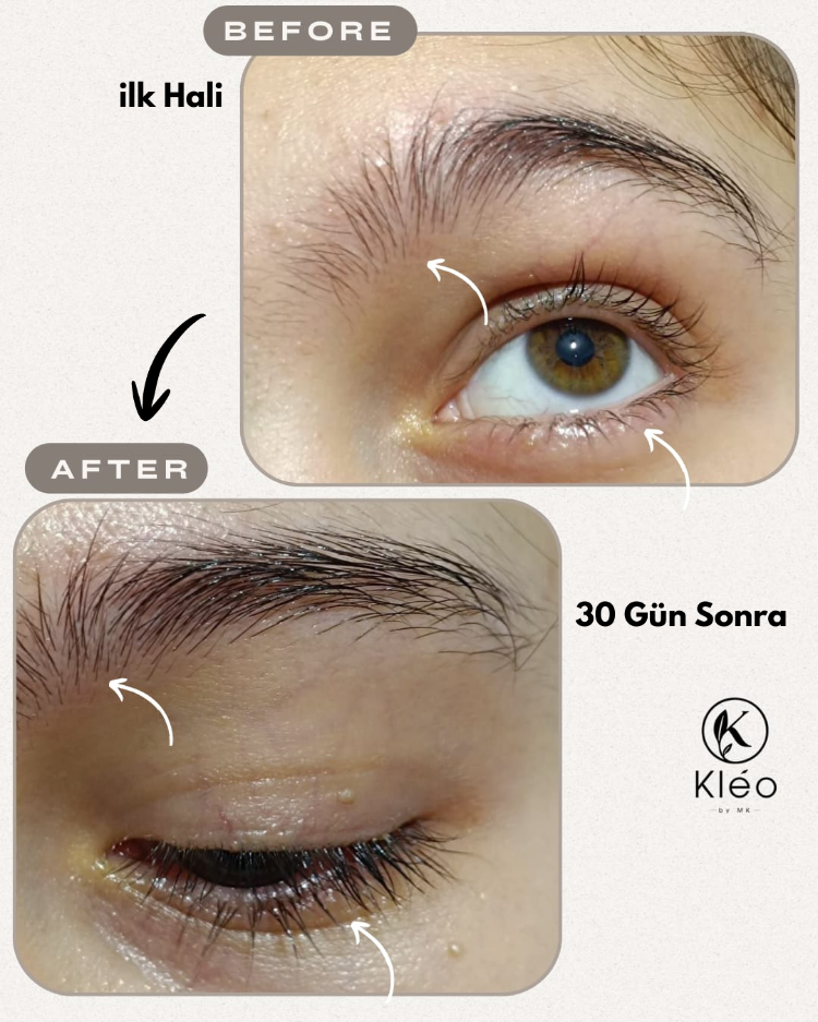 Kléo By MK Kombucha Özlü Kaş ve Kirpik Bakım Serumu – Seyrek ve Cansız Kökler İçin