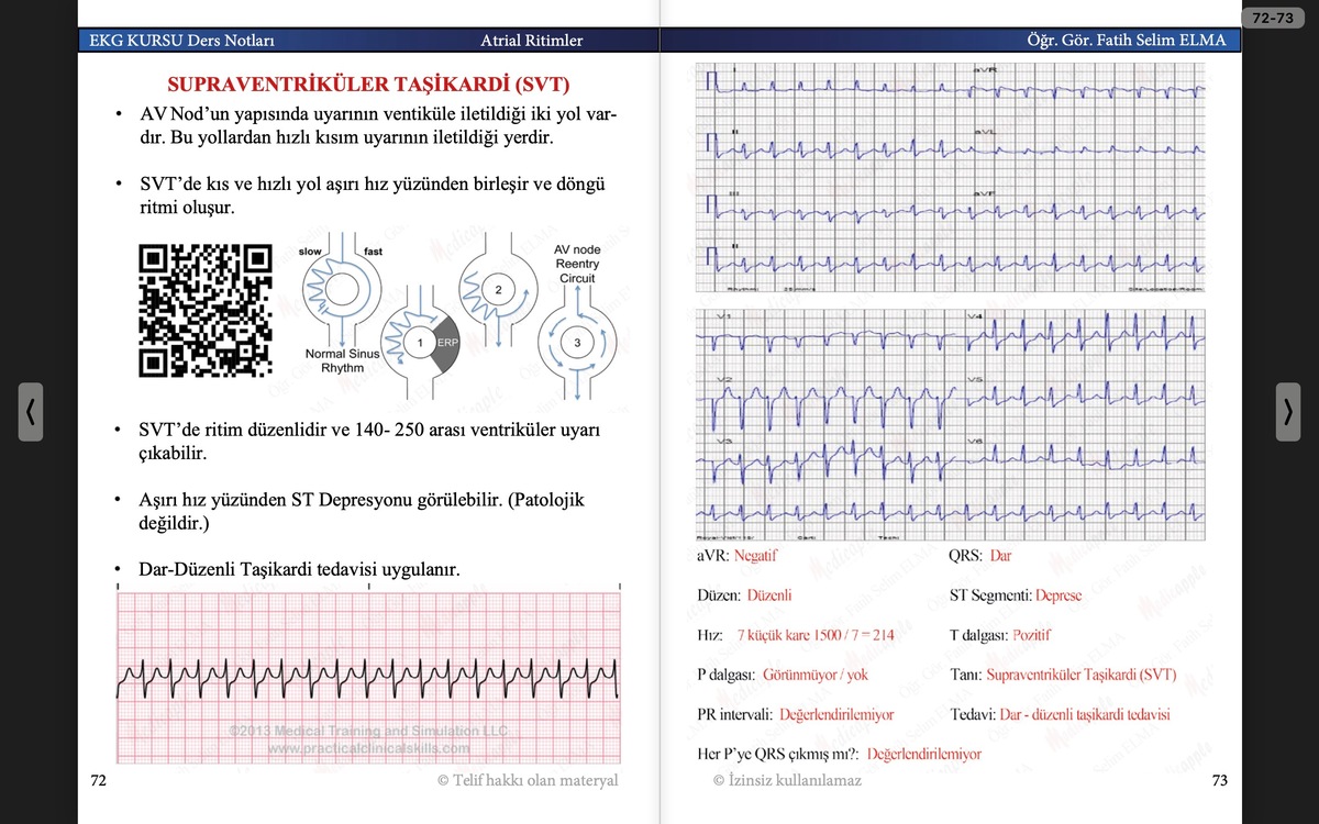 EKG KURSU Ders Notları Cep Kitabı (e-kitap)