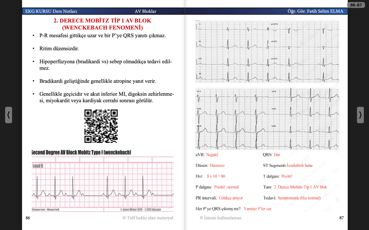 EKG KURSU Ders Notları Cep Kitabı (e-kitap)