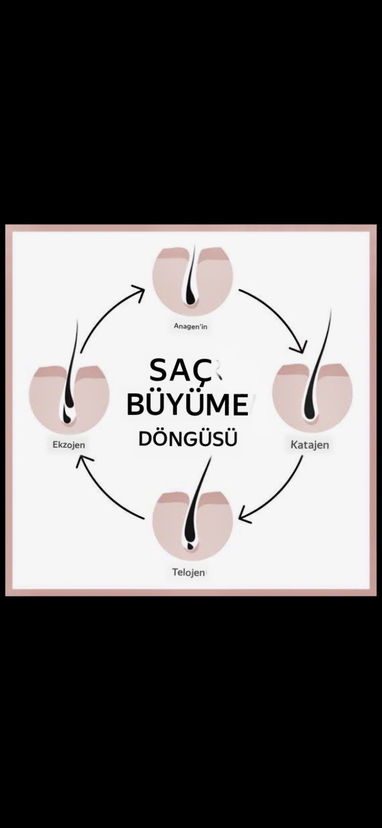 Aktif Karbon Genel Detoks- Saç-Cilt-Yüz-sivilce Sabunu %100 doğal