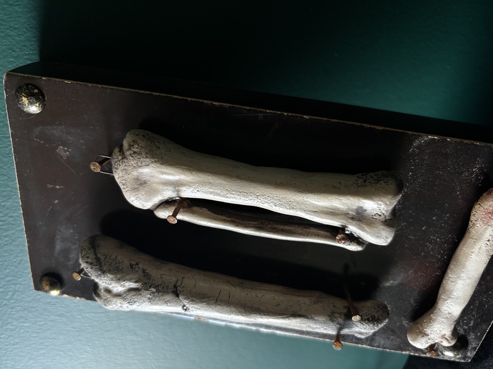 Bones Series - 3