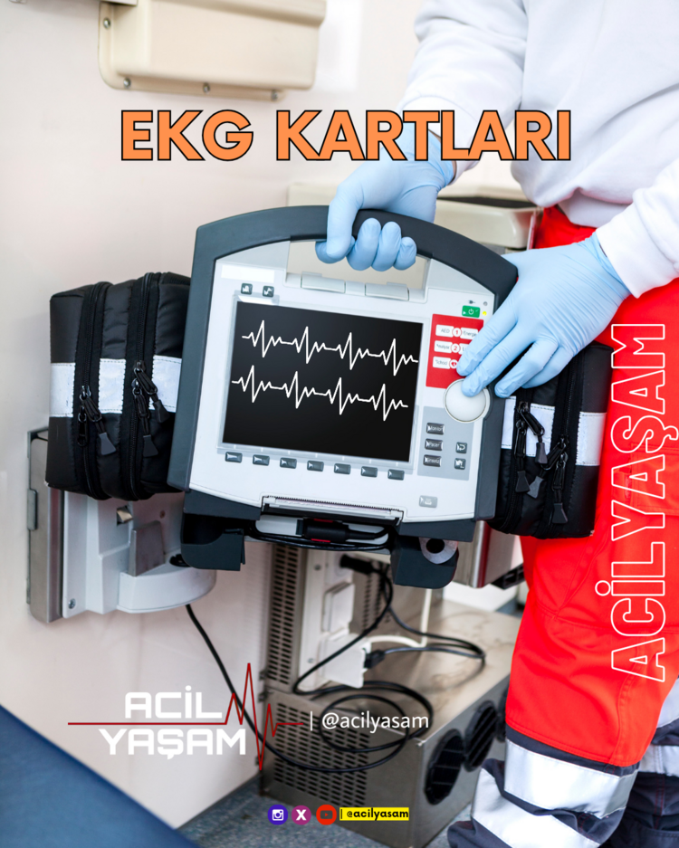 EKG KARTLARI PDF Dosyası
