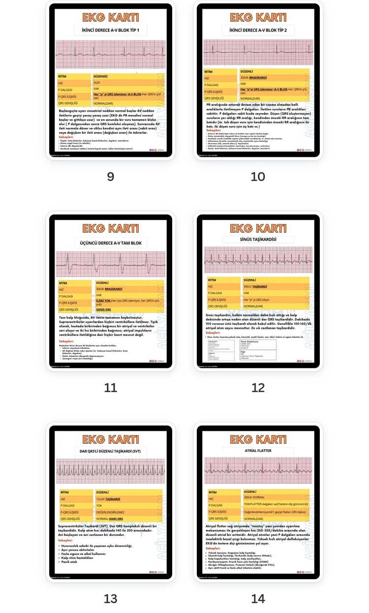 EKG KARTLARI PDF Dosyası