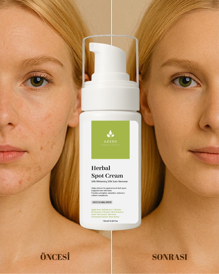 AKERD COSMETİCS LEKE KREMİ Beyazlatıcı Kararma