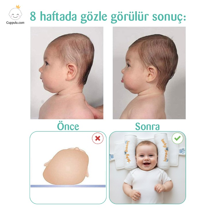 Ortopedik bebek düz kafa yastığı