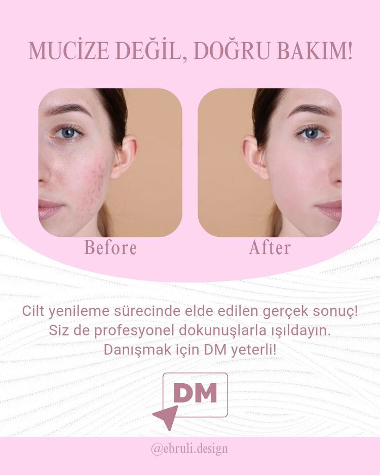 güzellik post şablon