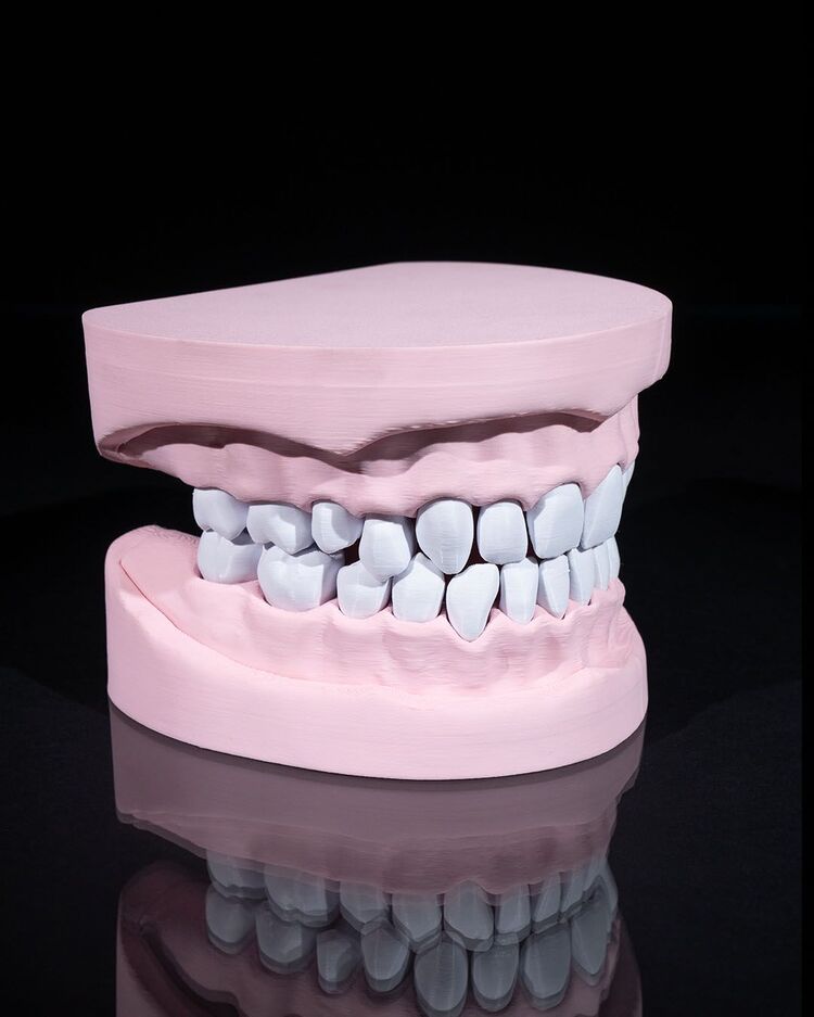 Diş Modeli