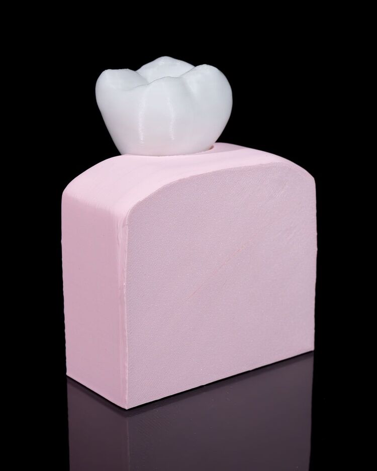 Implant Diş Modeli