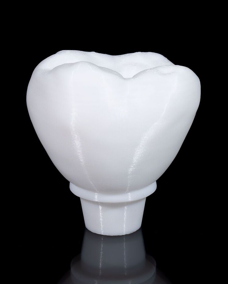 Implant Diş Modeli