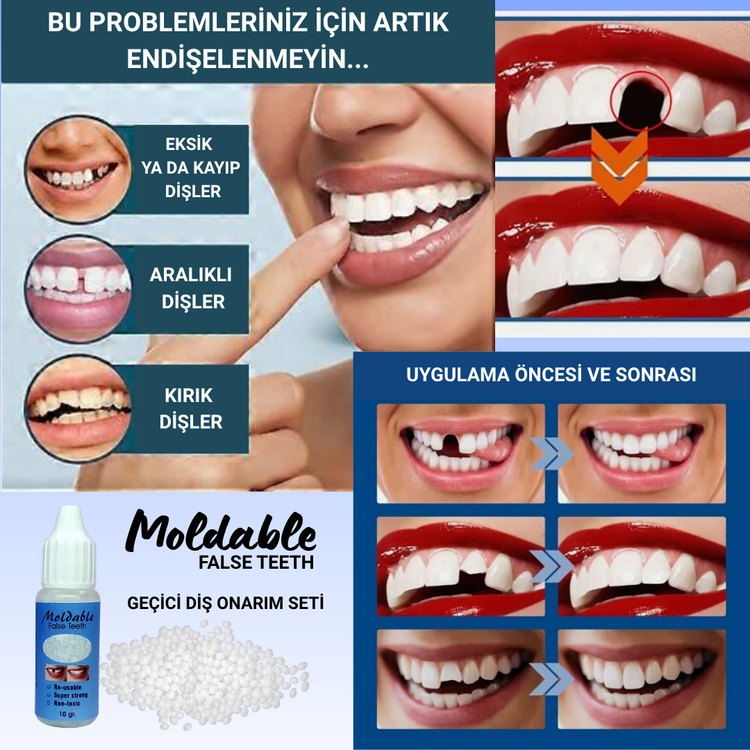 Moldable False Teeth Geçici Diş Onarım Seti,Takma Diş, Protez Diş, Geçici Diş, Diş Onarımı