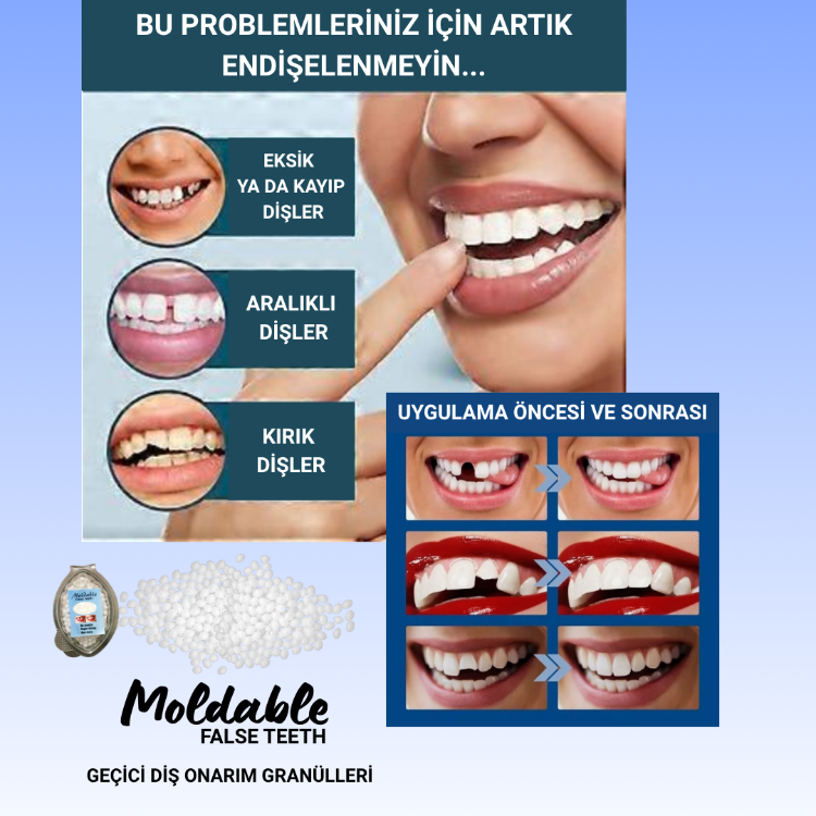 Moldable False Teeth Geçici Diş Onarım Granülleri 100+ adet, 7 geçici diş için (2 Gram)