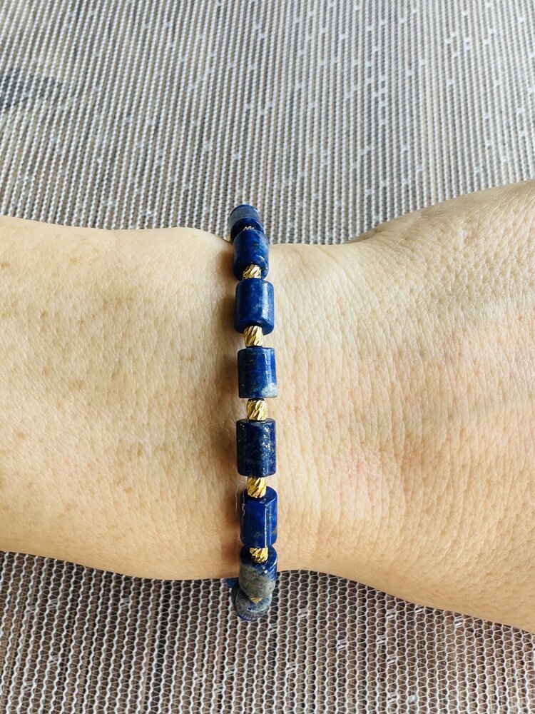 Lapis dorika bileklik