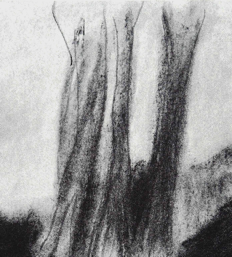 Ağaçlar / Trees