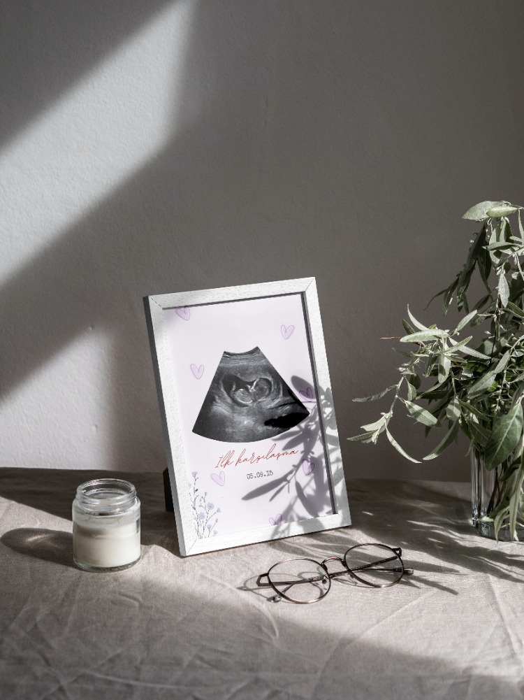 Kişiye Özel İlk Ultrason (Sonogram) Posteri | Hamilelik Duyuru ve Anı Tablosu ilk Tanışma