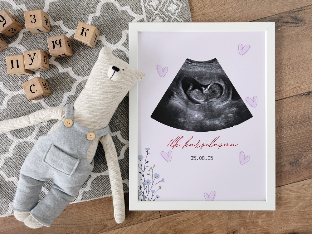 Kişiye Özel İlk Ultrason (Sonogram) Posteri | Hamilelik Duyuru ve Anı Tablosu ilk Tanışma