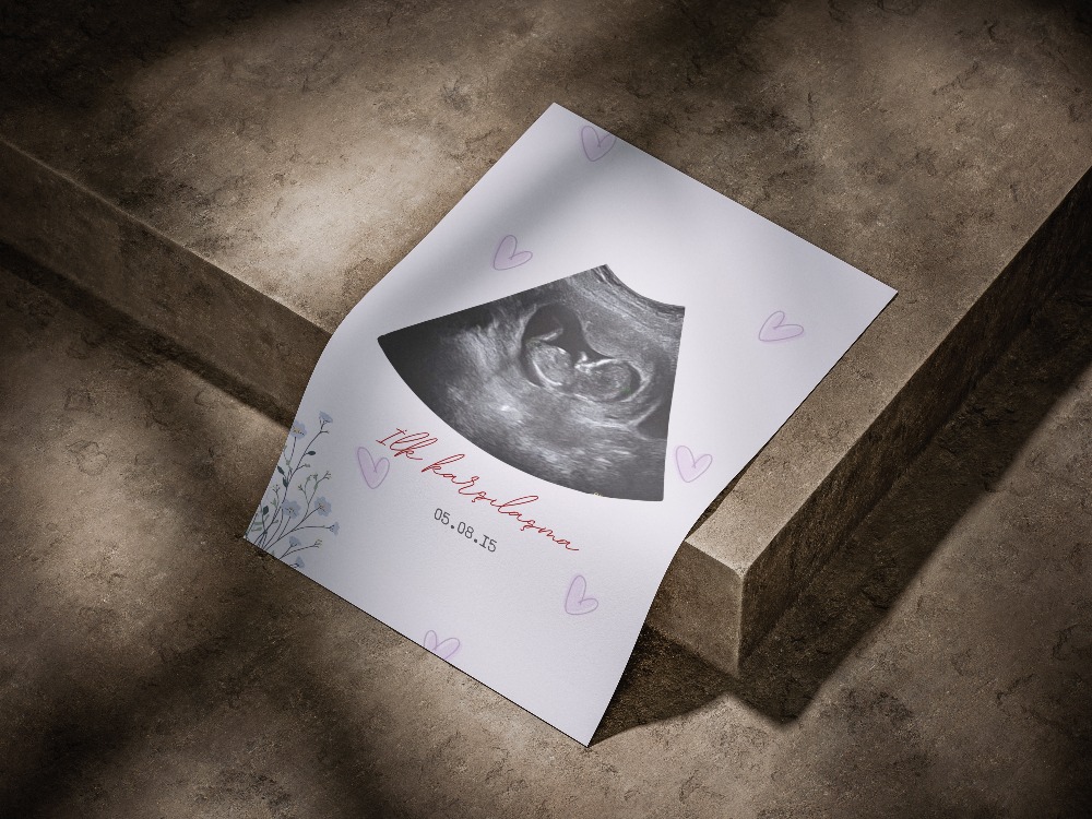 Kişiye Özel İlk Ultrason (Sonogram) Posteri | Hamilelik Duyuru ve Anı Tablosu ilk Tanışma